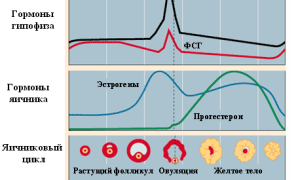 Боли в почках при месячных — причины, чем это опасно и что делать
