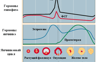 Боли в почках при месячных — причины, чем это опасно и что делать
