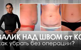 Как убрать живот после кесарева сечения? Упражнения + Видео для мам!