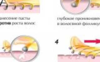 Результат удаления волос в зоне подмышек – эстетический и гигиенический эффект после шугаринга подмышечных впадин