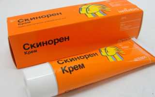 Скинорен: отзывы. Что лучше выбрать, крем или гель?