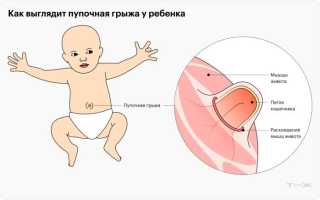 Как обрабатывать пупок новорожденного правильно и безопасно?
